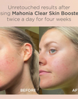 Mahonia Clear Skin Booster 25ml